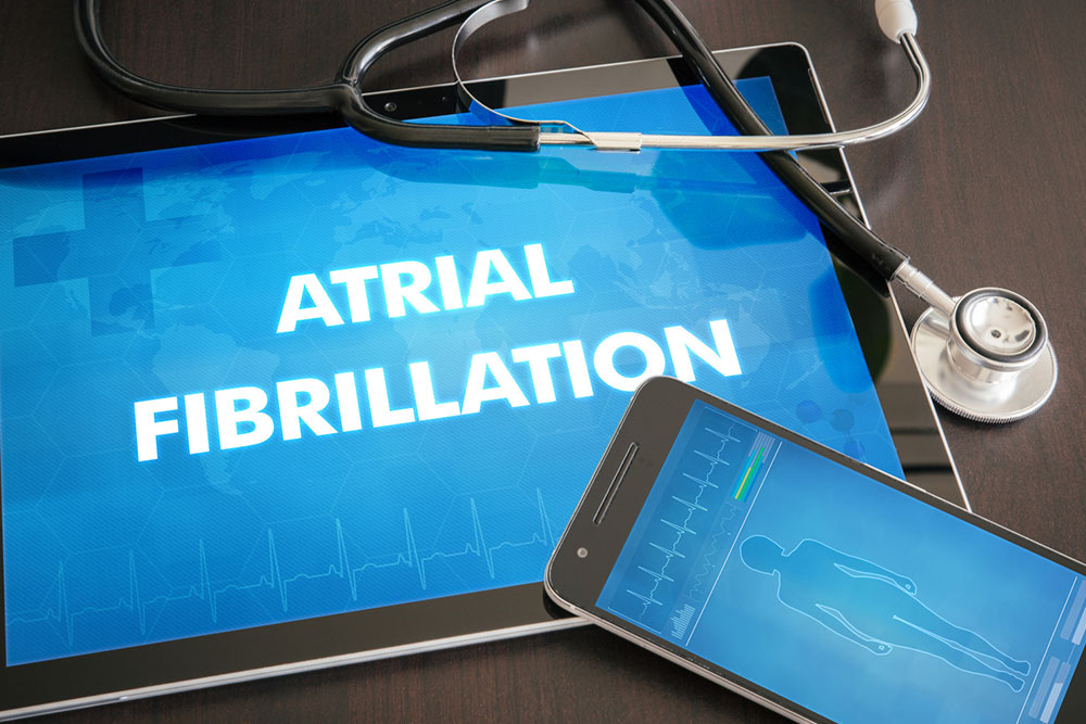 All You Need to Know about Atrial Fibrillation