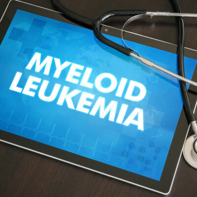 Diagnosis and treatment of chronic myeloid leukemia